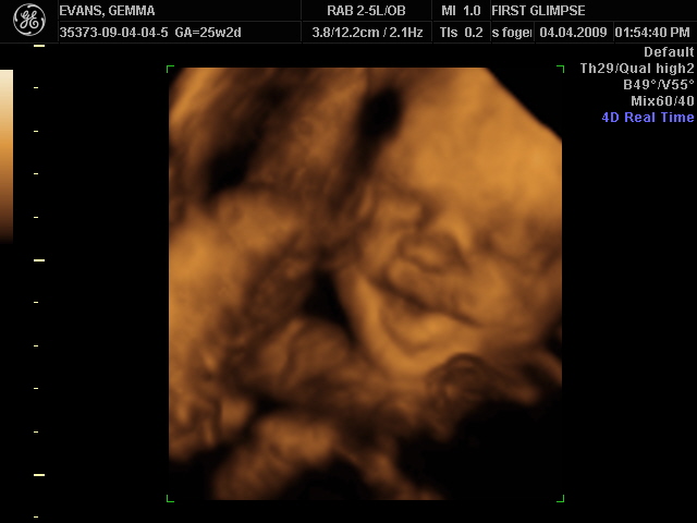 Harvey Scan